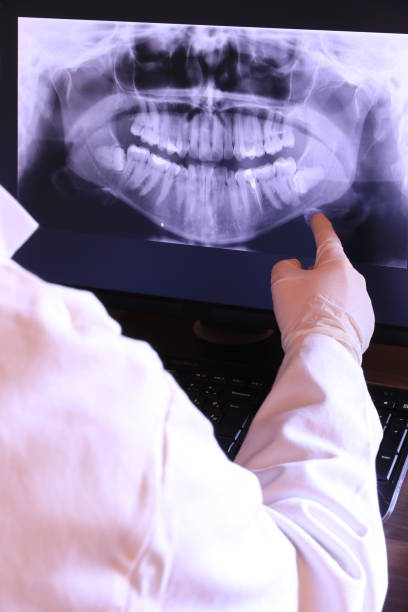 Best Emergency Dental Care for Abscessed Tooth in Hermann, MO
